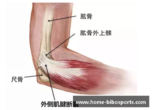 bibo必博球员跟腱拉伤：预防与康复策略详解